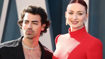 Joe Jonas habla abiertamente sobre sus retoques estéticos