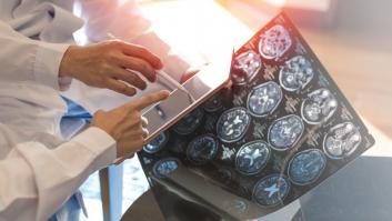 ¿Por qué los diabéticos tienen una mayor tendencia a desarrollar la enfermedad de Parkinson?