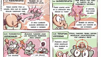 ¿Cómo se trata el cáncer de mama?