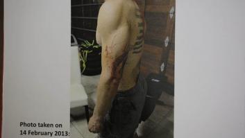 Salen a la luz las fotografías que incriminan a Pistorius