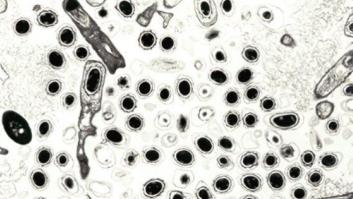 Alarma en Siberia por un brote de Ántrax: al menos 86 ingresados