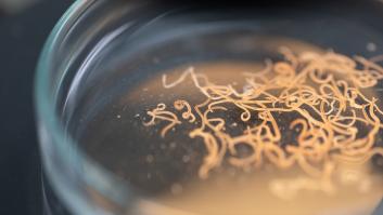 ¿Qué son los parásitos y qué enfermedades nos causan?