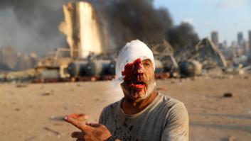 Las historias de dolor, resiliencia y solidaridad que deja la explosión de Beirut