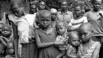 El hambre en el mundo, en 10 datos