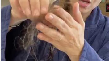 Caída del cabello, el desconocido efecto secundario del coronavirus