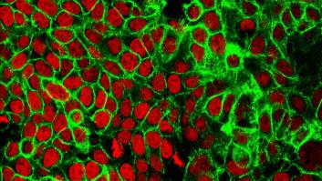 Investigadores españoles resuelven un misterio del cáncer de hace más de 45 años