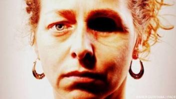 Ester Quintana perdió el ojo por la actitud "imprudente" de los Mossos, según el juez