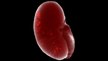 Un equipo de científicos descubre la manera de cultivar células nuevas de riñón