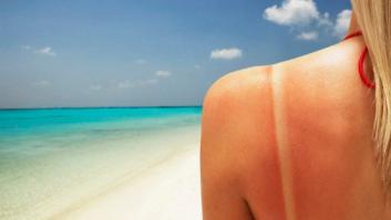 9 zonas en las que siempre se nos olvida ponernos crema solar