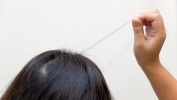 Cuando la ansiedad te lleva a tirarte de los pelos: tricotilomanía