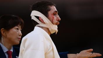 La gimnasta Simone Biles también se retira de la final individual