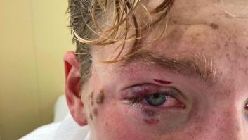 "No veía, pensé que mi ojo se había caído": el codazo que obliga a un nadador a dejar Tokio
