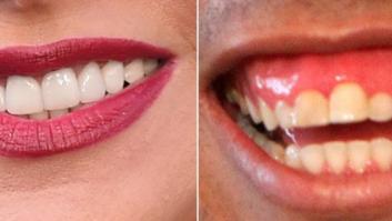 ¿De qué famosos son estas sonrisas? (TEST)