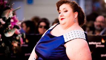 Qué es el lipedema, la enfermedad que ha obligado a Itziar Castro a adelgazar 15 kilos