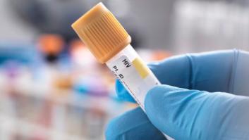 Segundo caso de un paciente de VIH curado doce años después