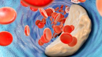 ¿Cuáles son los alimentos que reducen el colesterol?