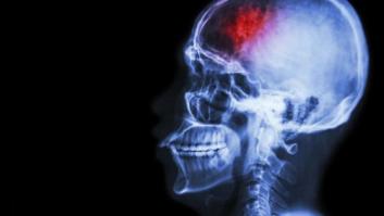 Un estudio revela por qué el cerebro nos lleva a encadenar una mentira tras otra