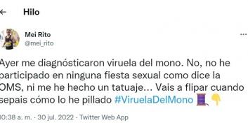Da la vuelta a Twitter al contar cómo se contagió de la viruela del mono: "Aún estoy alucinando"