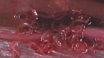 Detectados los primeros casos de anisakis tras consumir pescado congelado