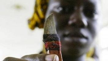 'Mutilación genital masculina'