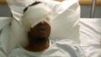 Un hombre arranca los ojos a otro en plena calle en Bruselas