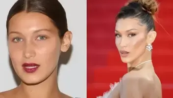 Adultos que se hicieron la cirugía estética de adolescentes desvelan de qué se arrepienten