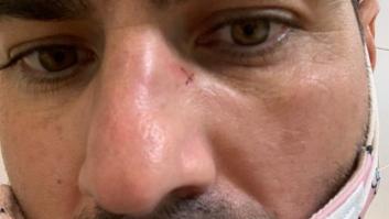 Un usuario del SEPE denuncia ser víctima de una "paliza" de dos trabajadores