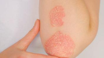 Cómo afecta la segunda ola del coronavirus a la piel