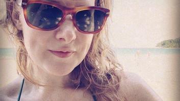 Puede que ya sea tarde para preocuparte por el cáncer de piel. Para mí lo fue