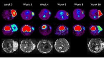 Un equipo de científicos españoles triplica la supervivencia de los que sufren metástasis cerebral