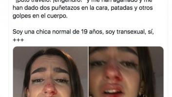 Los Mossos investigan la paliza a una joven trans de 19 años en Barcelona