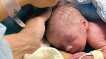 El aumento de las cesáreas está impactando en la evolución humana