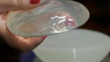 Francia estudia prohibir las prótesis mamarias por un cáncer asociado