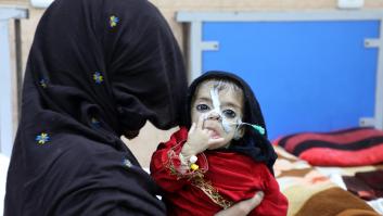 ONU: 49 millones de personas en 43 países se encuentran en niveles de emergencia de hambre