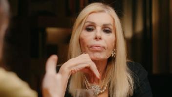 "Metí la pata": Bibiana Fernández confiesa cuál es la operación estética de la que se arrepiente