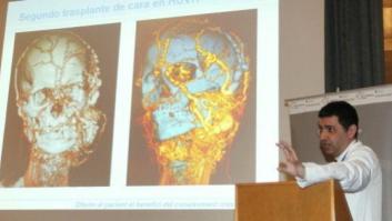El Vall d'Hebron realiza el segundo trasplante de cara de su historia