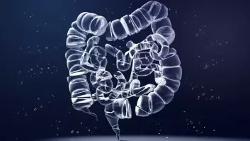 Este nuevo tratamiento de cáncer de colon tiene resultados "espectaculares", con un asterisco