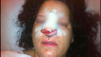 Naciones Unidas condena a España por tratos crueles durante una detención en Córdoba