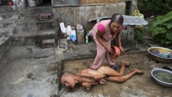 40 años de agente naranja en Vietnam