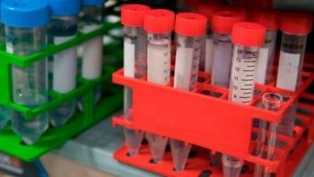 Un equipo científico liderado por españoles descubre la clave para atacar el cáncer de páncreas