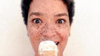 31 fotos increíbles que demuestran que las pecas molan