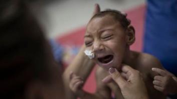 Los 'niños del zika', un año después