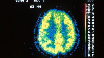 ¿Qué ocurre en el cerebro durante la meditación?