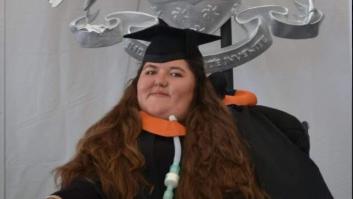 Tengo 22 años y vivir con un agujero en el cuello no es el fin del mundo