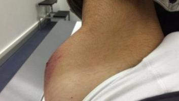 Luis Moya, el famoso copiloto de Carlos Sainz, atropellado en Barcelona