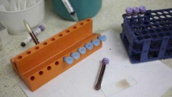 El virus del zika combate el cáncer en el cerebro adulto mejor que la quimioterapia