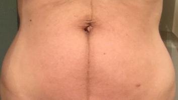 Incidentes de 10 vientres