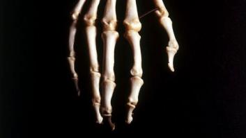 Investigan el hallazgo de una maleta llena de huesos en un trastero de Fuengirola (Málaga)