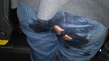 Una sustancia abrasiva en el asiento de un autobús de Madrid causa quemaduras a dos personas