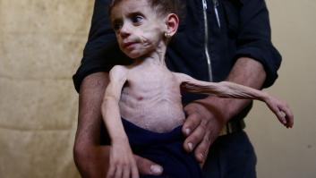 La población asediada de Siria se alimenta de basura para sobrevivir